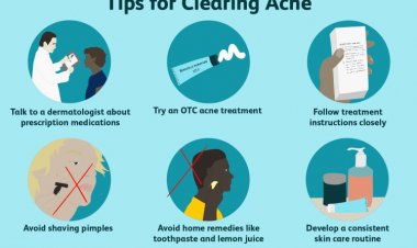 Best Methods For Teenagers For Treating Acne