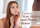 Top 5 Rid Tips of Acne Stickers and Pimple Stickers
